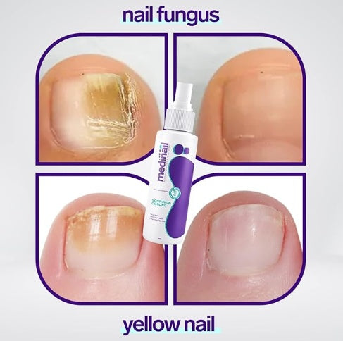 Jaysuin - Nail Fungus Spray