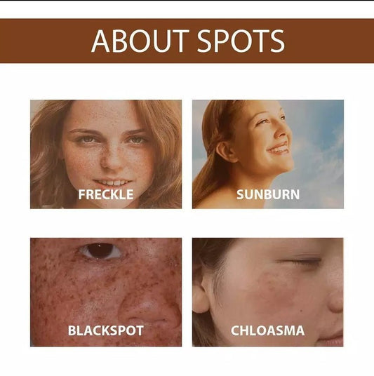 Anti Freckle Serum